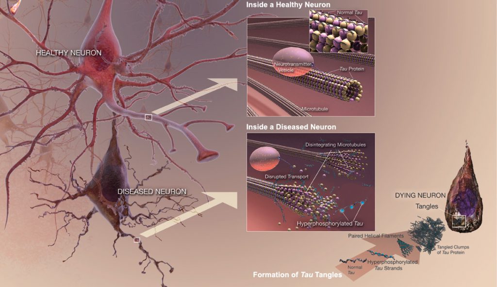 Tau_tangle_formation