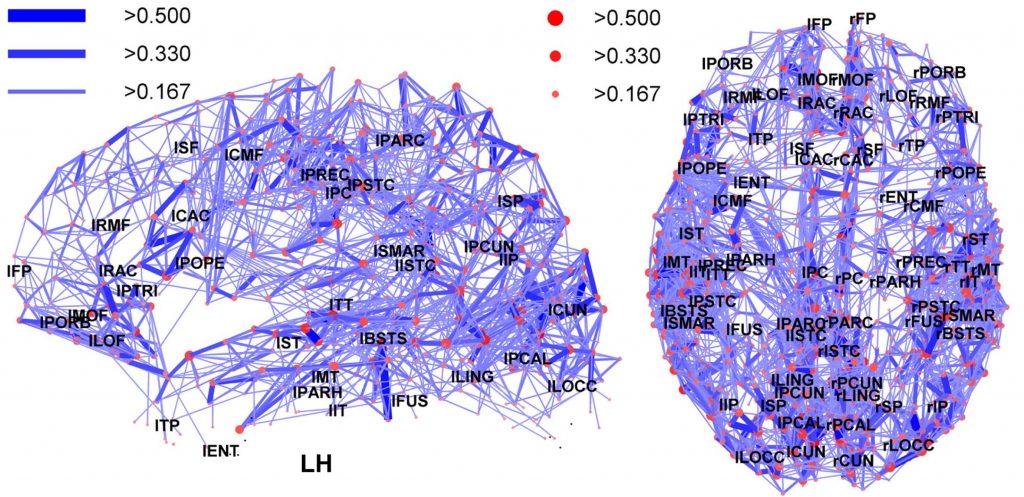 network_representation_of_brain_connectivity